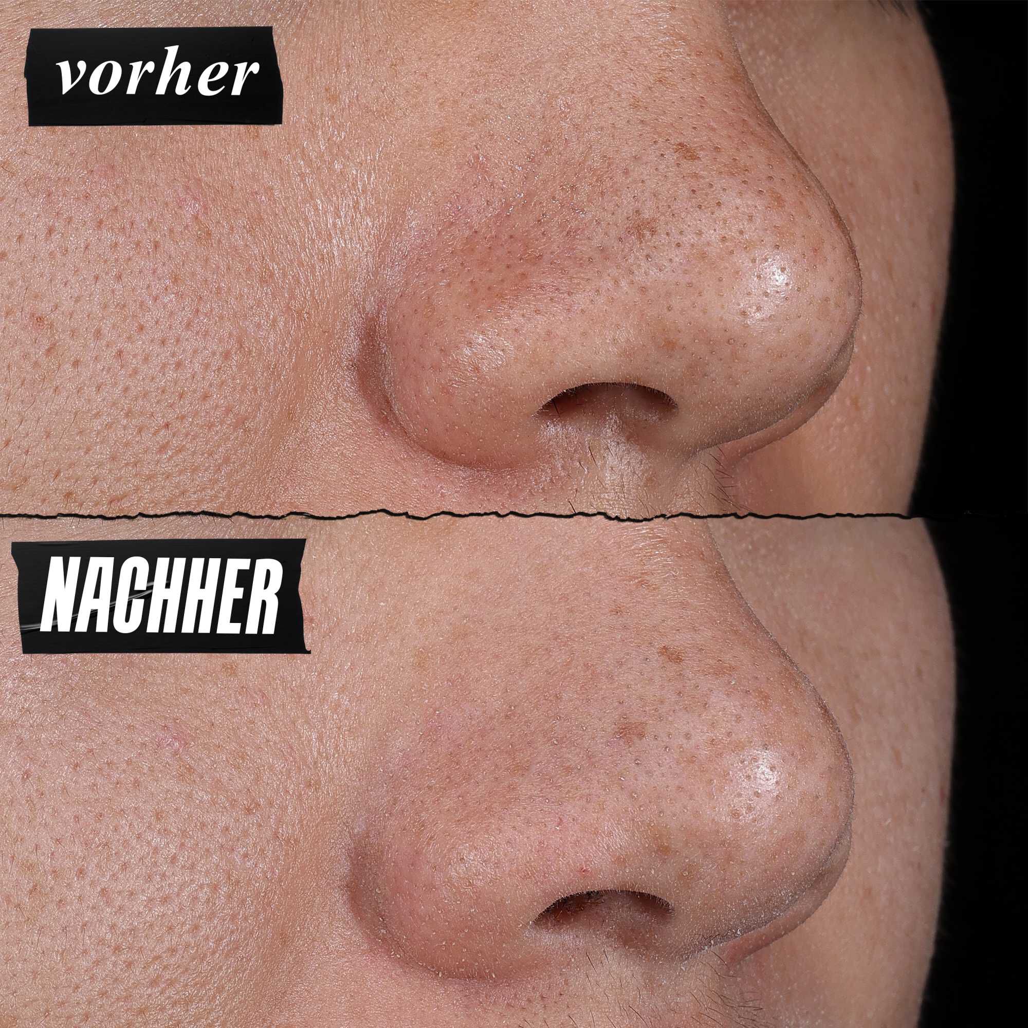 Vorher-Nachher-Foto – Kiehl's Rare Earth Deep Pore Cleansing Masque reduziert sichtbar Poren