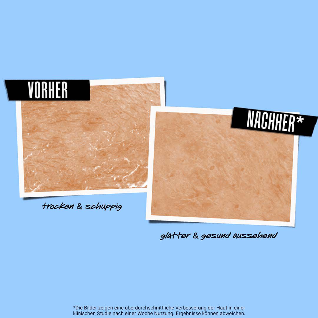 Vorher Nachher Bilder der 10 Tage Master Reinigung