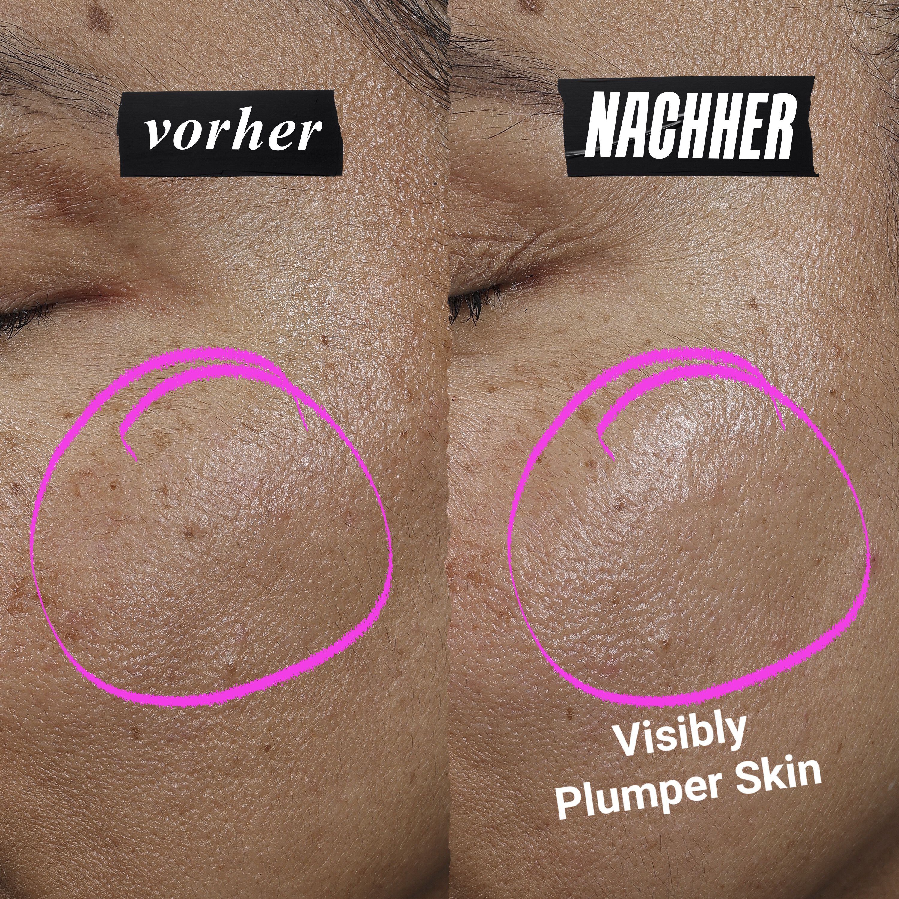 1cc* CollaShot Plump Serum