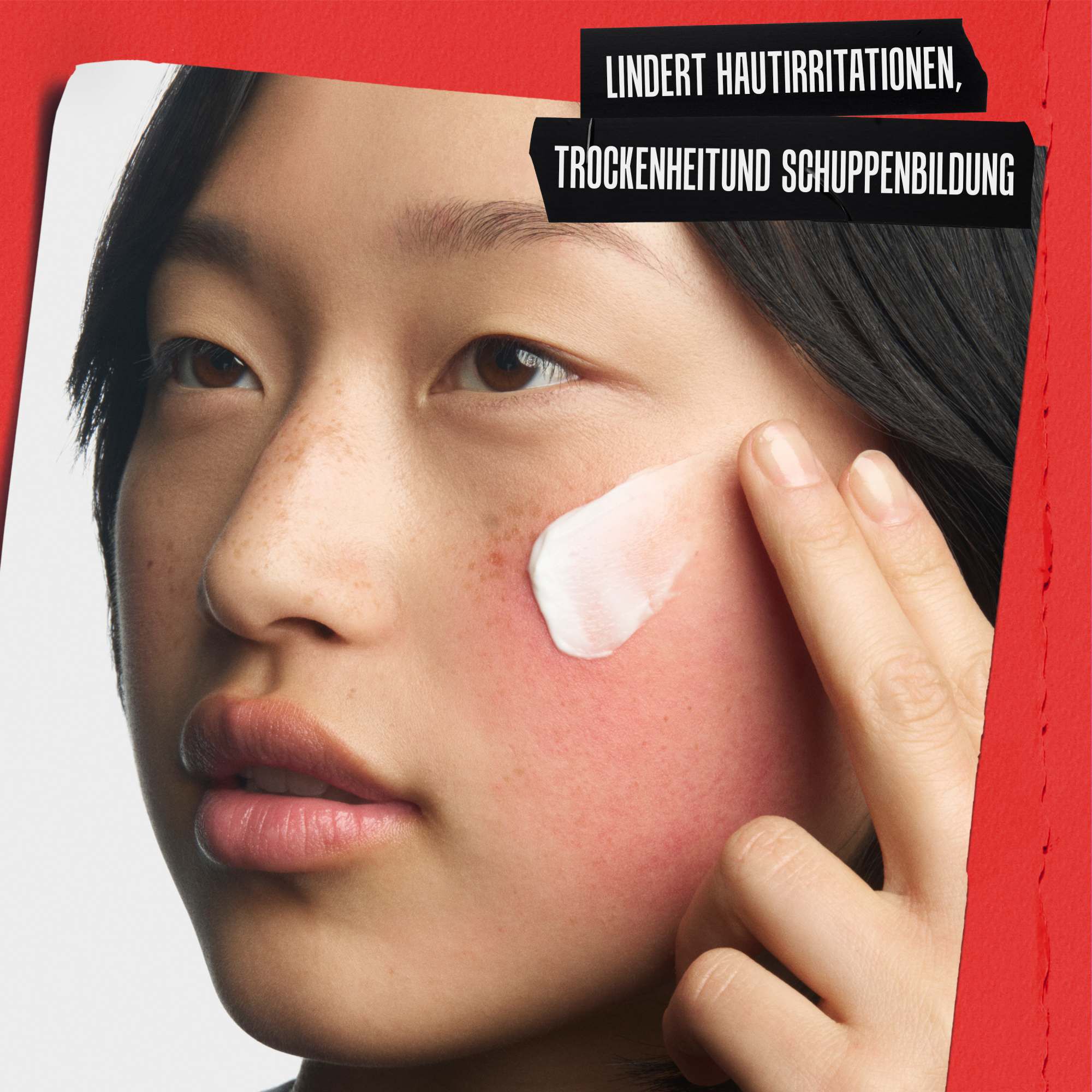 Nahaufnahme einer Regenerationscreme, die auf eine irritierte Wange aufgetragen wird. Text: LINDERT UNANGENEHMES HAUTGEFUHL, TROCKENHEIT UND SCHUPPENBILDUNG.