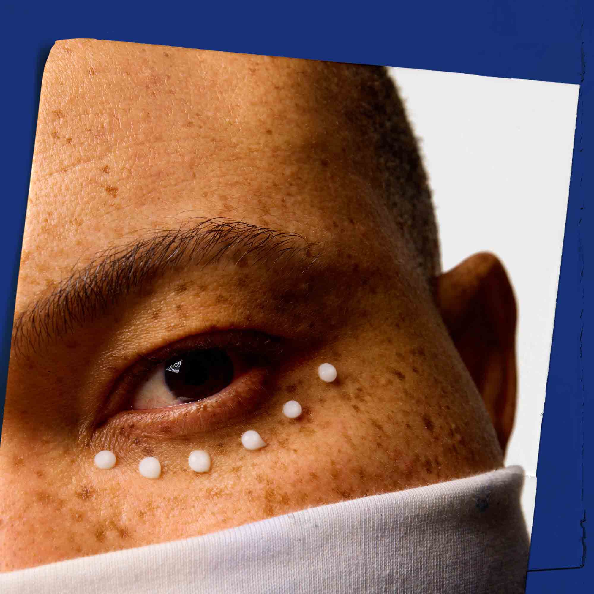 Nahaufnahme der Haut um die Augenpartie, betupft mit Facial Fuel Eye Fuel.