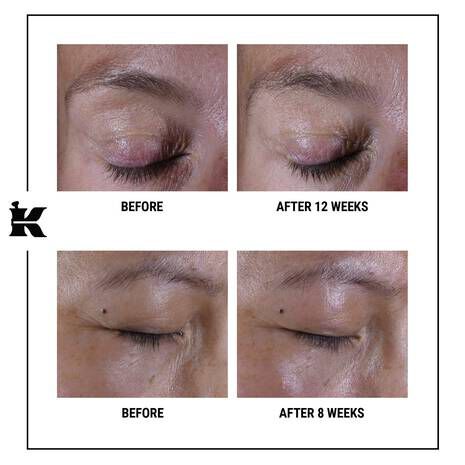 Super MultiCorrective Eye Zone Treatment Kiehl’s