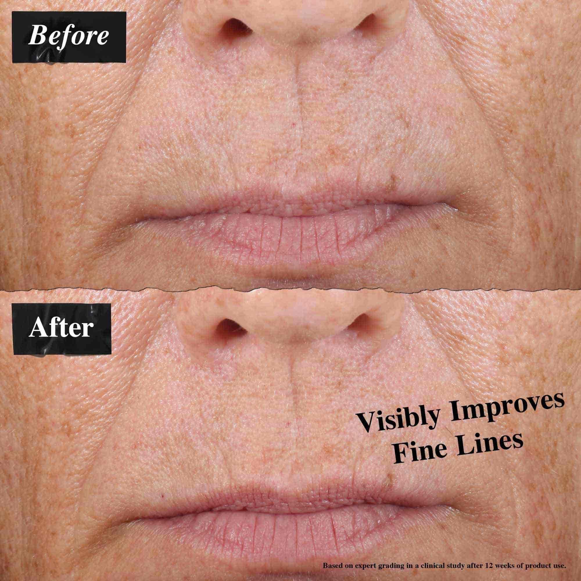 Ein Vorher-Nachher-Vergleich, der sichtbar reduzierte feine Linien nach der Anwendung von Midnight Recovery Concentrate Gesichtsol zeigt.