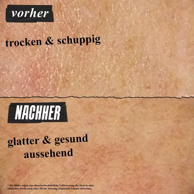 Vorher-Nachher-Bild: Vor der Anwendung der ULTRA FACIAL CREAM ist die Haut trocken und schuppig, danach glatter und gesund aussehend.