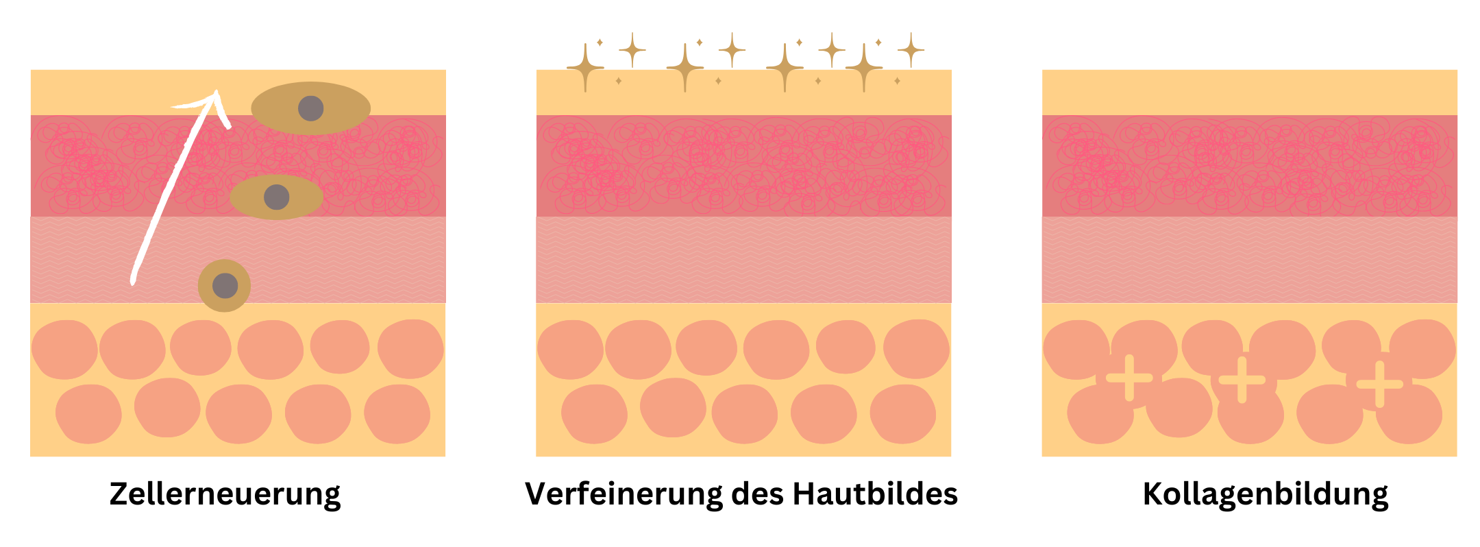 Dargestellter Querschnitt der Haut samt ihrer Prozesse