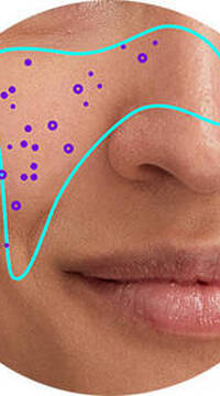 Derma Reader von Kiehl's: Analyse der verstopften Poren